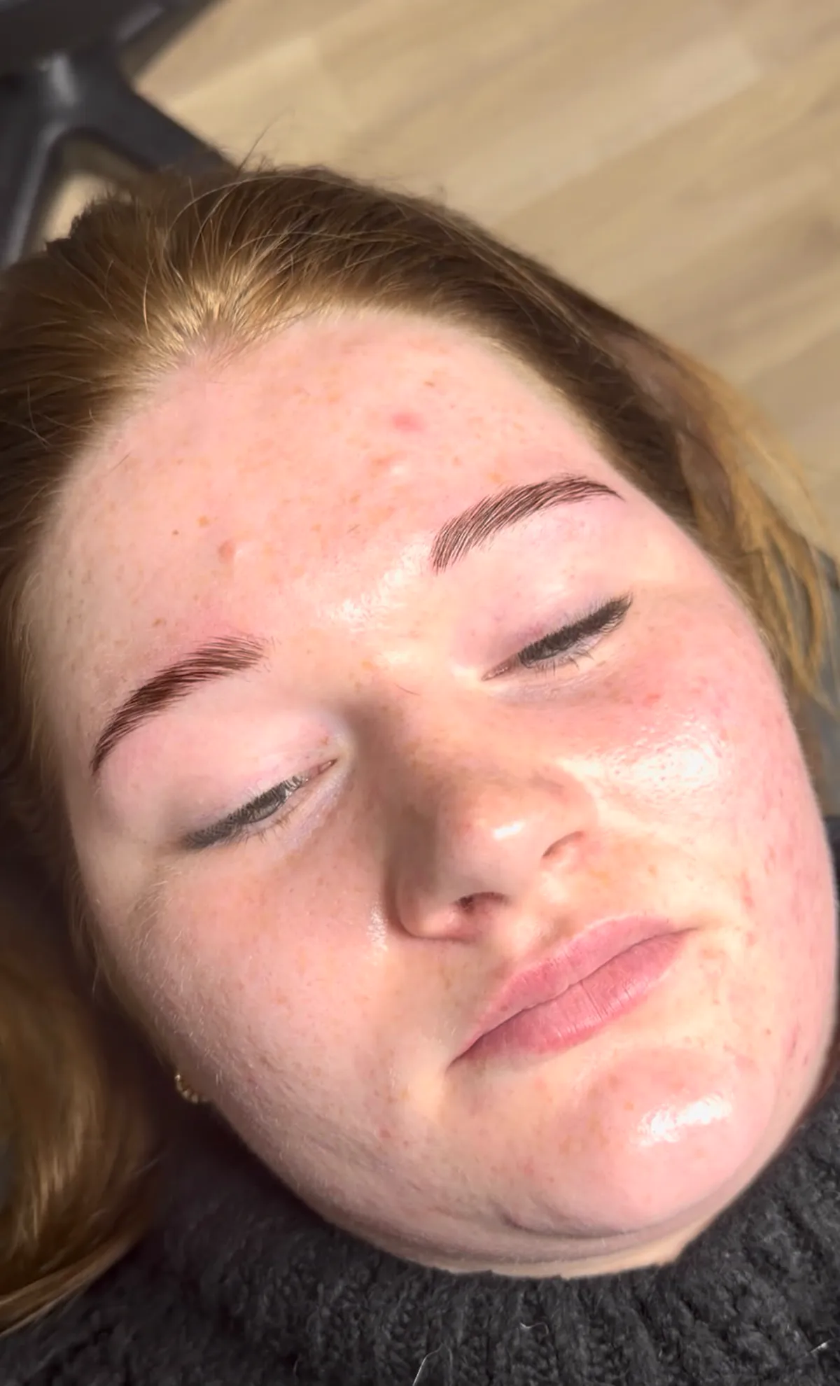 Gesichtsbehandlung Ergebnis